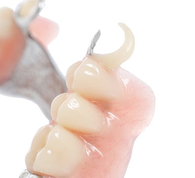 Prothèse Dentaire Complète Résine Acrylique A3 - 168 Pièces Supérieur Et Inférieur - Pour Démonstration, Bricolage